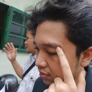Dianiaya, Mahasiswa FK UISU Laporkan Oknum Taruna Akmil Ke Denpom 1/5 Medan