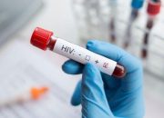 Trend HIV-AIDS di Banda Aceh Capai 541 Kasus, Illiza: Pengendalian Dimulai dari Gampong dan Skrining Kampus