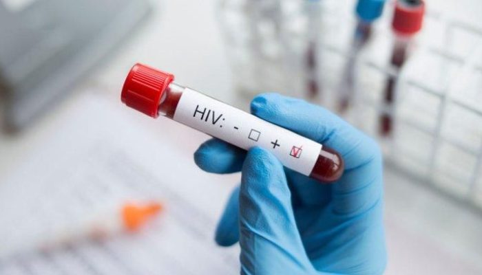 Trend HIV-AIDS di Banda Aceh Capai 541 Kasus, Illiza: Pengendalian Dimulai dari Gampong dan Skrining Kampus