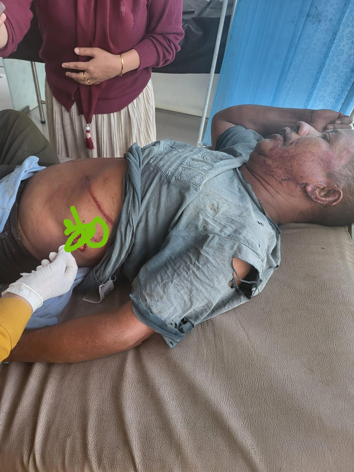 Abdul Mutalib korban amukan gajah liar sedang jalani perawatan intensif di Puskesmas Blang Rakal (dok IST)