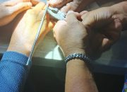 Cincin Susah Move On dari Jari Manis, Wanita Ini Terpaksa Minta Tolong Petugas Damkar